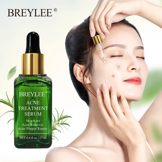 BREYLEE Acne Treatment Face Serum Mask Anti Acne Pimple Scar Remover Moisturizing Whitening Skin Care Facial Essence Cream 17ml (Chinese )